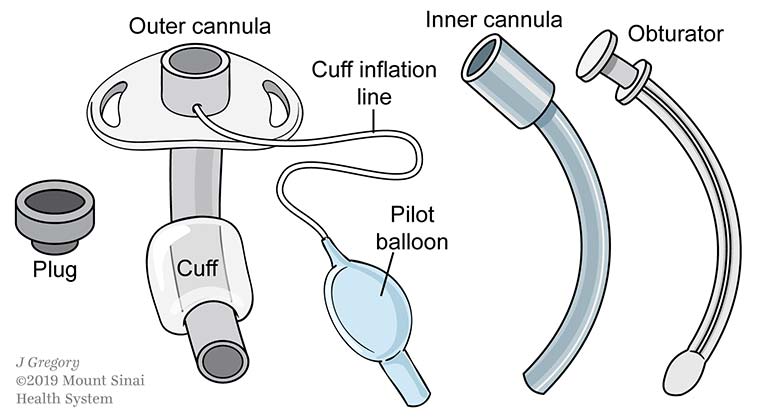 components of a Trachestomy