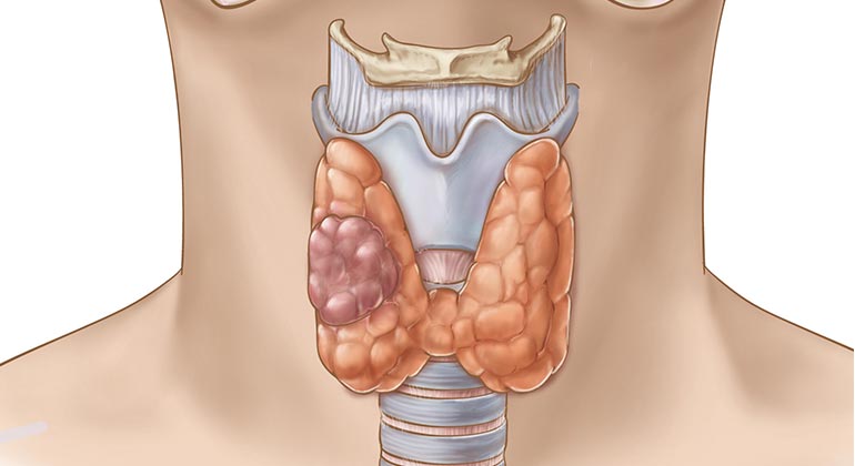 Diagram of Thyroid