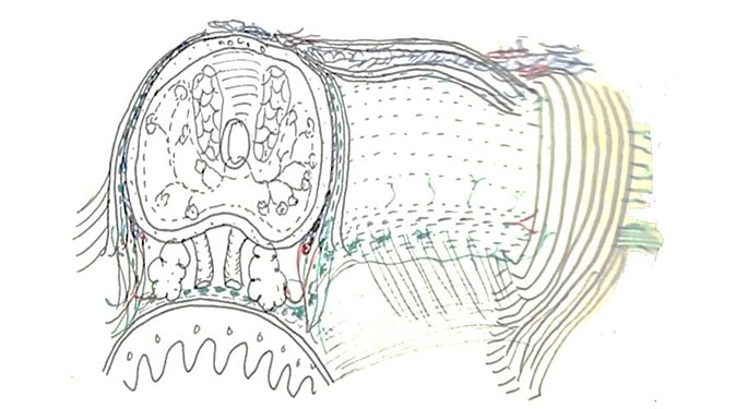 Sketch drawing of prostate 