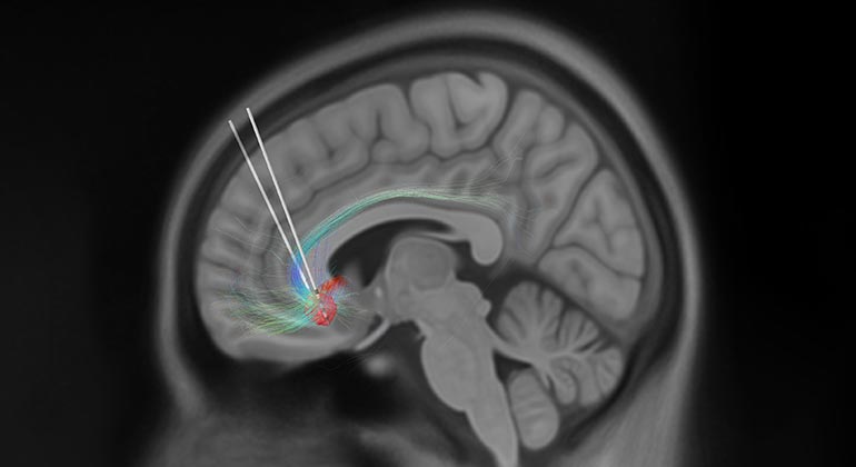 Neuroscientists Decrypt the Mystery of Rapid Eye Movements