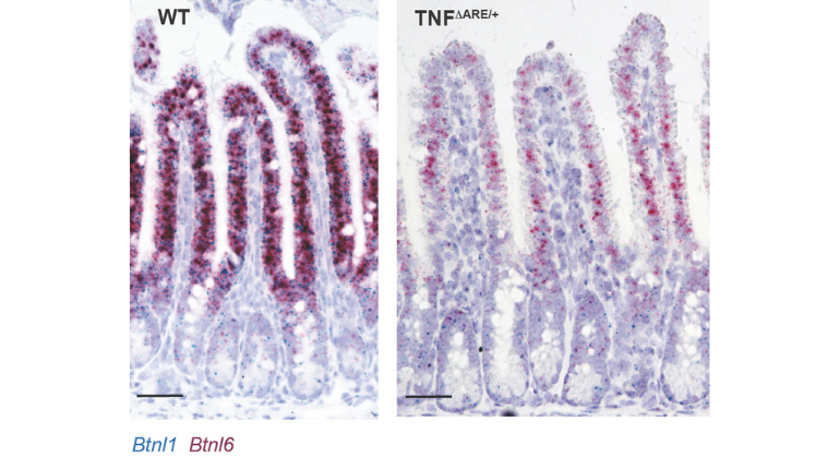 炎症性腸疾患の発症に関連する細胞メカニズムを解明(Mount Sinai-Led Team Identifies Cellular Mechanisms That May Lead to Onset of Inflammatory Bowel Disease)